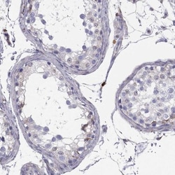 CNOX Antibody, Novus Biologicals 25 &mu;L; Unlabeled:Antibodies, Polyclonal